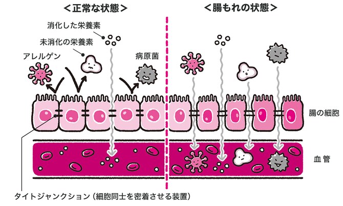 【専門医が教える腸活】サラダより日本食と地中海食がいい。日本人の体質に合った食材の選び方_img1