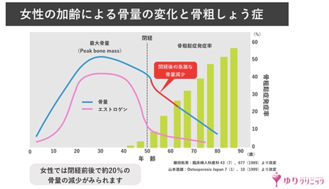 目の窪み、クッキリほうれい線。スキンケアで改善しない顔の悩みは「骨」の老化が原因かも!?_img0