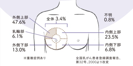 乳がん？時々おこる胸の痛みの原因は？　胸痛危険度をチェック！_img0